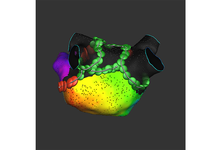 VARIPULSE