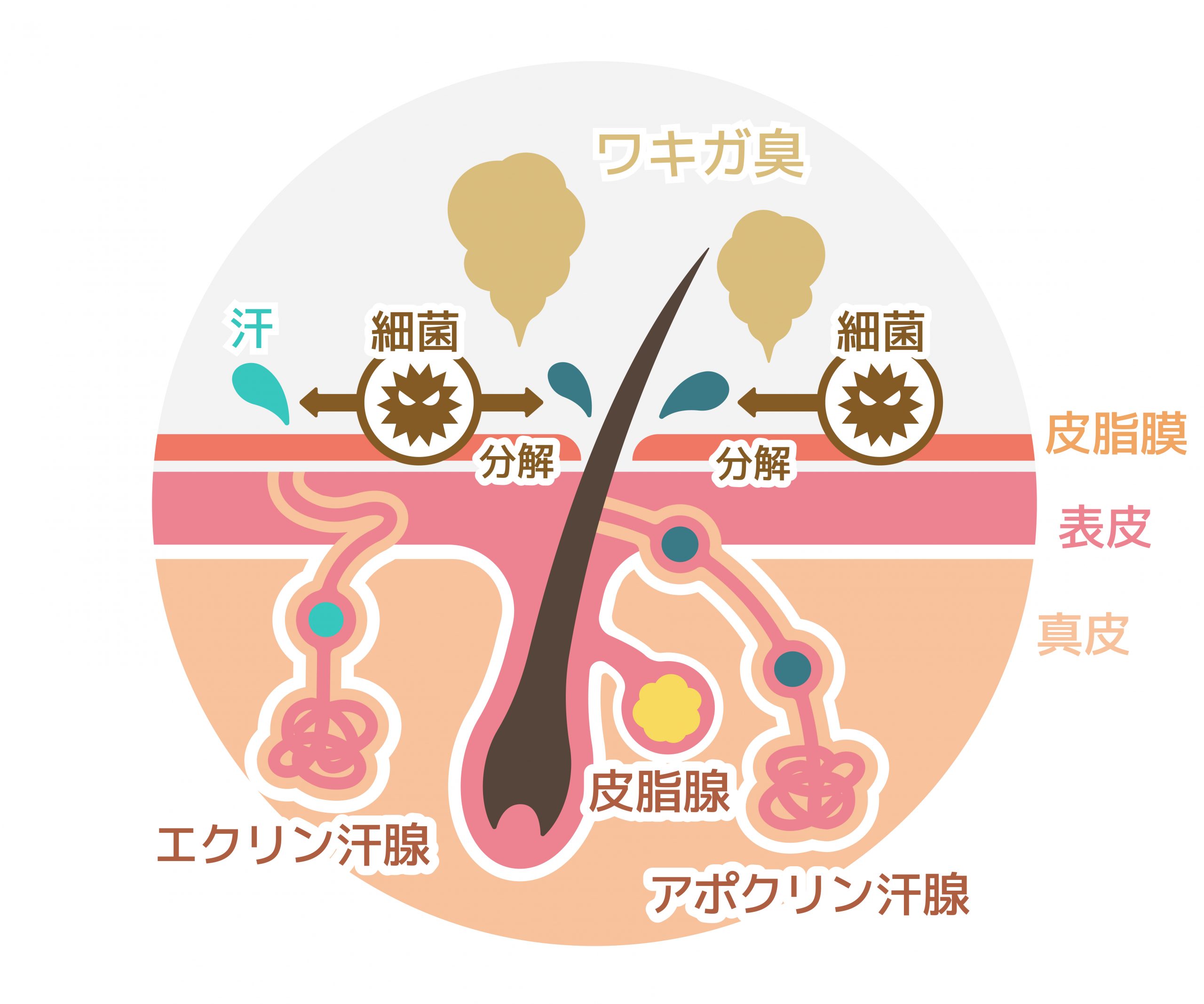 腋臭症のニオイが発生する仕組みを示す皮膚と汗腺のイメージ図